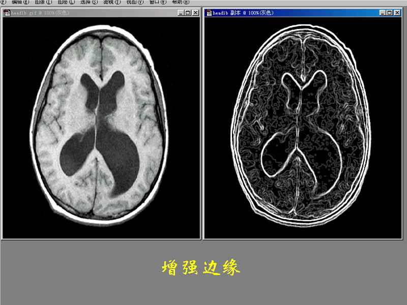 图像边缘增强图片